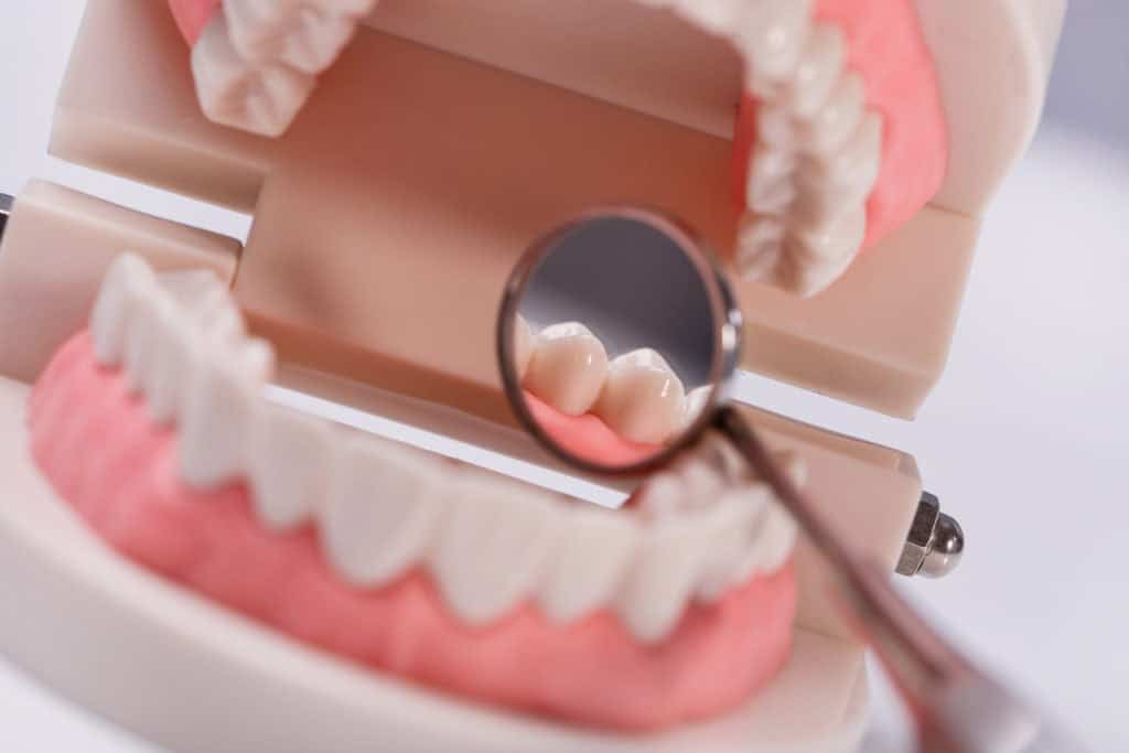 espejo dental