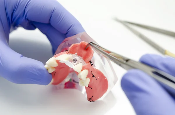 Suturas para Odontología: Cuáles son y algunas recomendaciones — figura 2