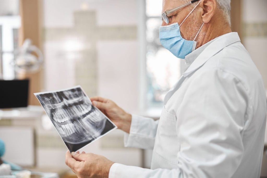 Radiografías Dentales: Los problemas más comunes y cómo evitarlos — figura 2